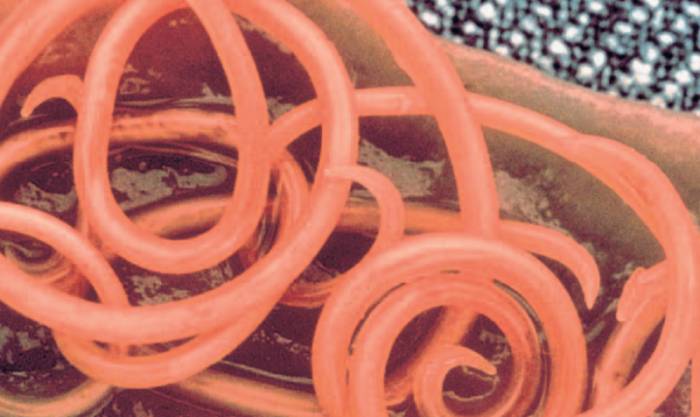 тканевые глисты