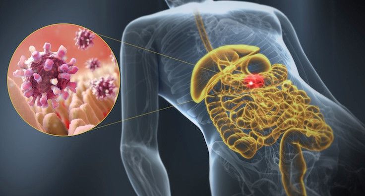 протекание заболевания