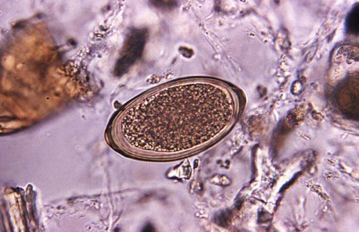 яйца глистов