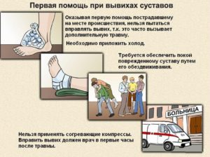 Схема оказания первой помощи при вывихе голеностопа Первая помощь при вывихе голеностопа