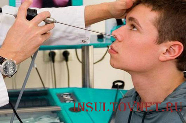 Лечение гайморита