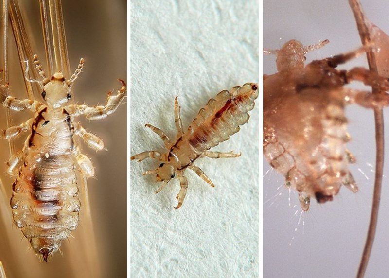 разновидности вшей