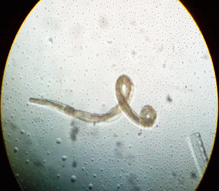 Острица - гельминт - заболевание Энтеробиоз