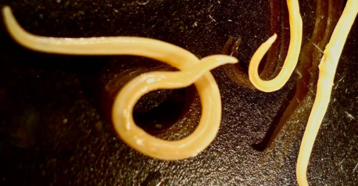 Как избавить ребенка от паразитических червей?